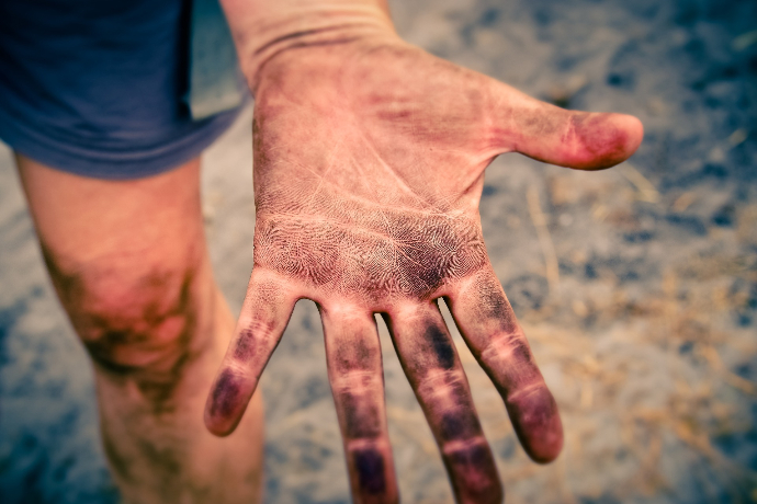 Prévention de la dermatite professionnelle